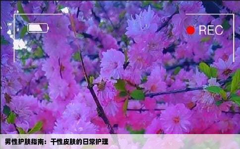 男性护肤指南：干性皮肤的日常护理